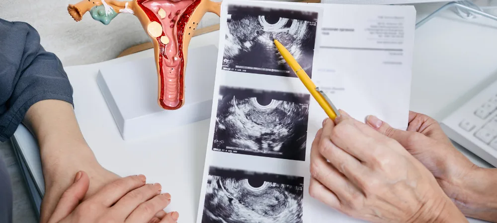 Gynecology consultation and ultrasound at the Boudra Fertility Center in Fes