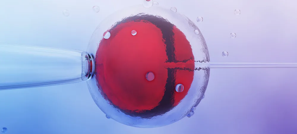 Micro-injection d’un spermatozoïde dans un ovocyte, technique ICSI