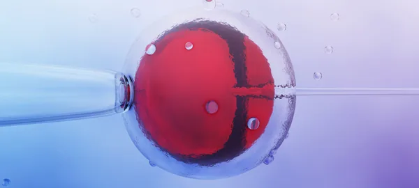 Micro-injection d’un spermatozoïde dans un ovocyte, technique ICSI